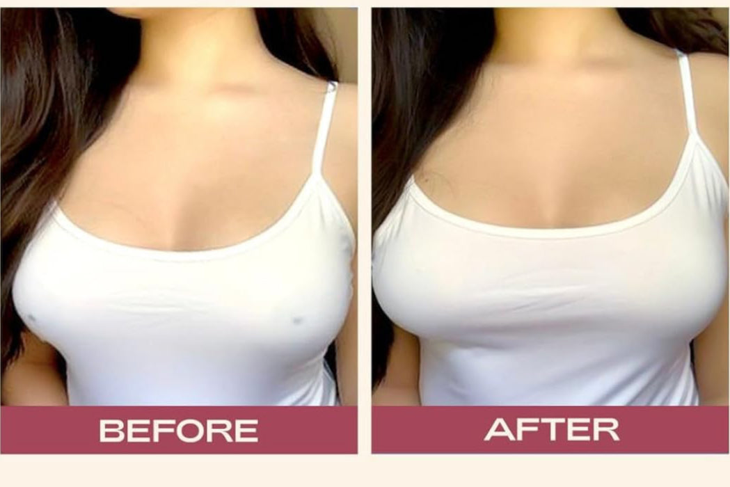 Svilene nalepke za prsi (5x)